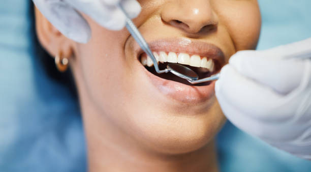 Best Emergency Wisdom Tooth Extraction in Lumberton, NC